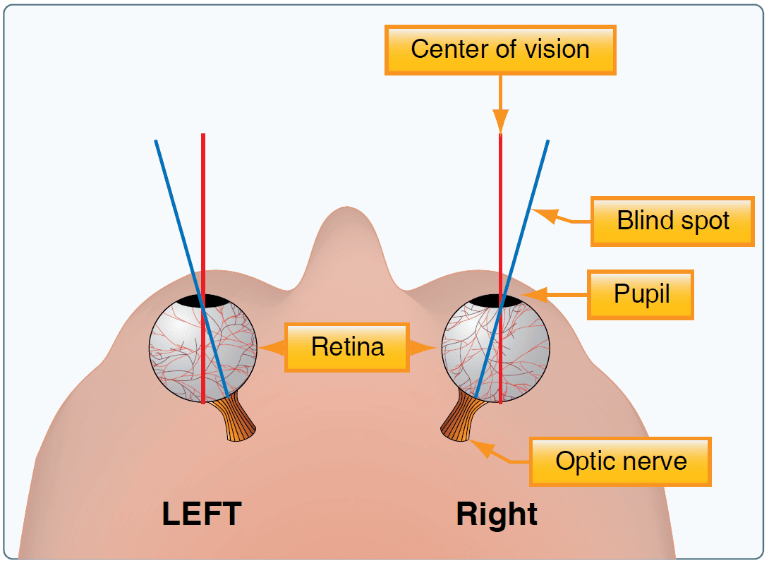 Central blind spot Vision in Flight